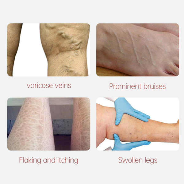 AUQUEST Varicose Veins Relief Cream