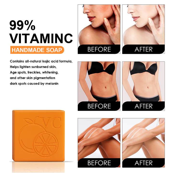 Oveallgo Vitamin C Whitening Soap