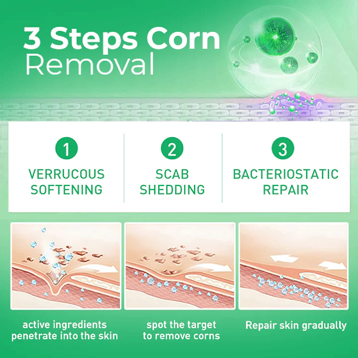 MEDix Active Corn Remover