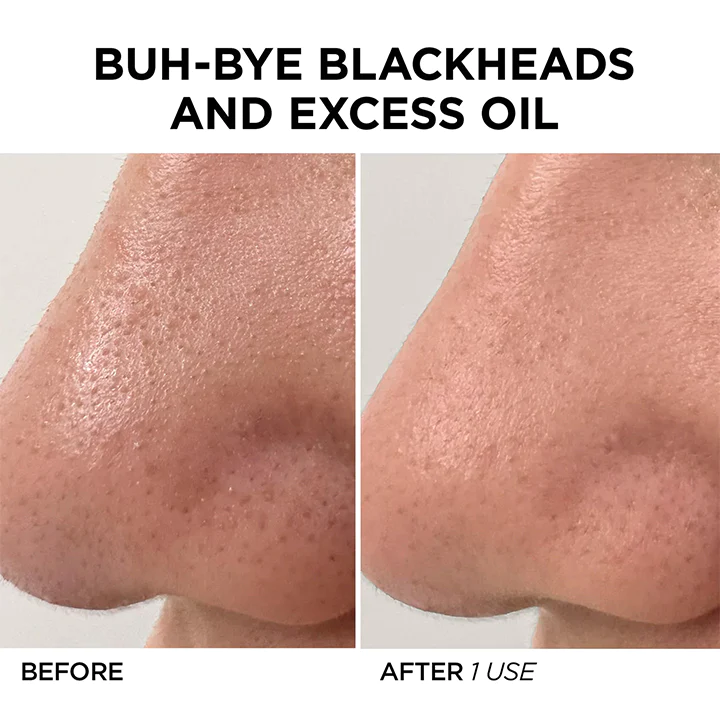 BioLap Salicylic Acid Cleanse Mask Stick