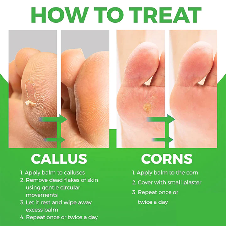 MEDix Active Corn Remover