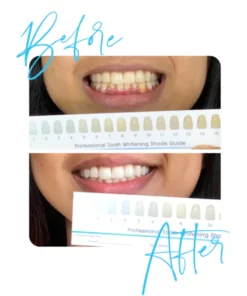 LANTHOME Teeth Whitening Mousse