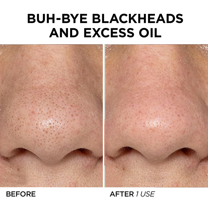 BioLap Salicylic Acid Cleanse Mask Stick