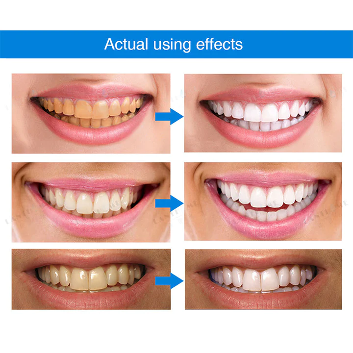 LANTHOME Teeth Whitening Essence