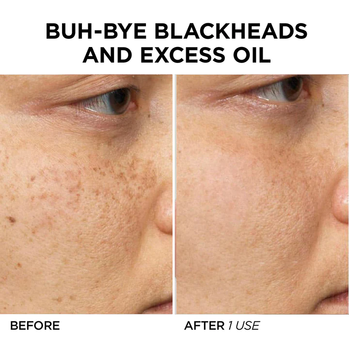 BioLap Salicylic Acid Cleanse Mask Stick