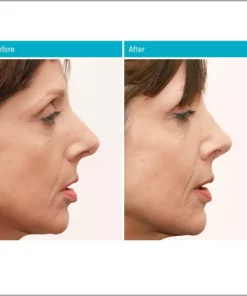 Sci-Effect Nose Lift Shaping Oil