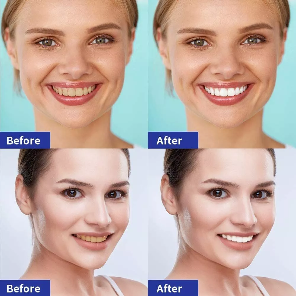 LAFEIGE Teeth Whitening Tooth Essence