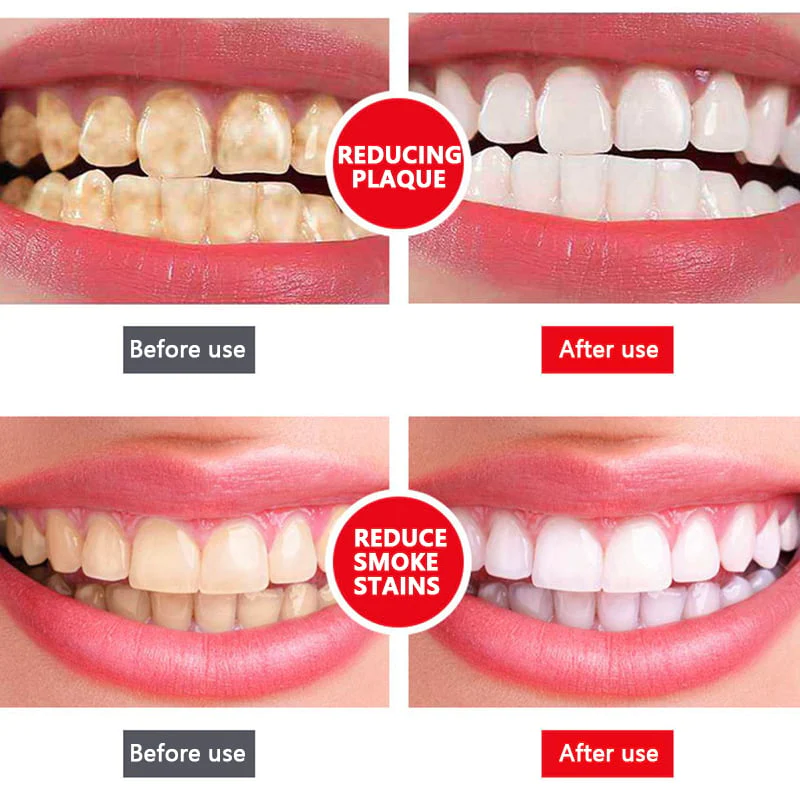 Ceoerty PRODent Probiotic Whitening Toothpaste