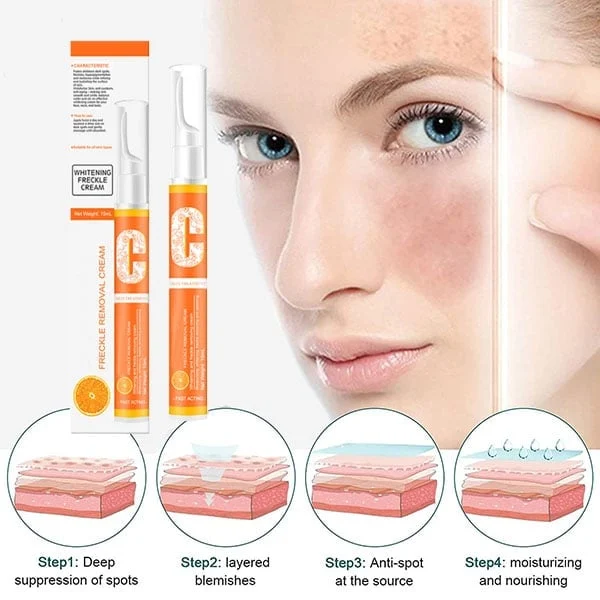 Vitamin C Freckle Dark Spot Removal Cream