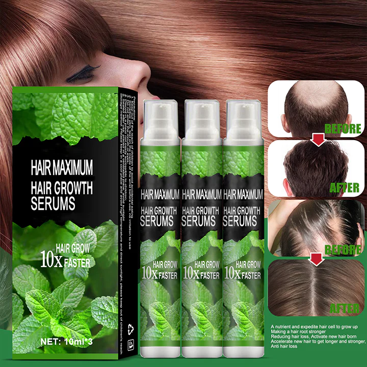 flysmus Herbal Hair Growth Spray