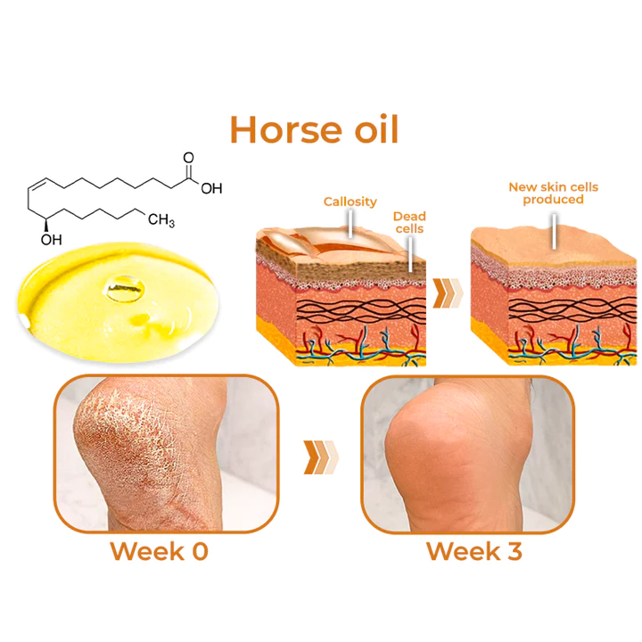 Oveallgo Horse Oil Foot Callus Remedy Balm