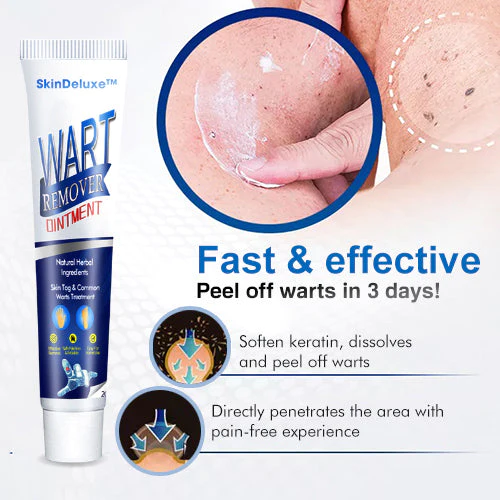 SkinDeluxe Wart-Removal-Ointment