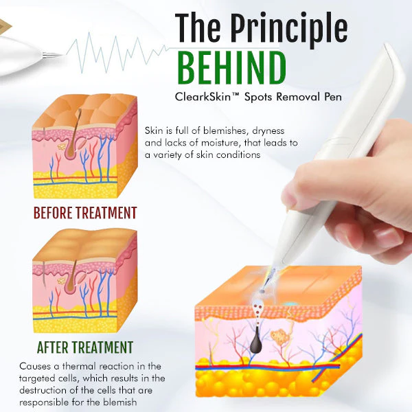 ClearSkin Spots Removal Pen