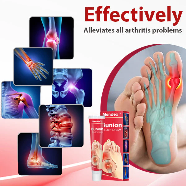 Mendex Bunion Relief Cream