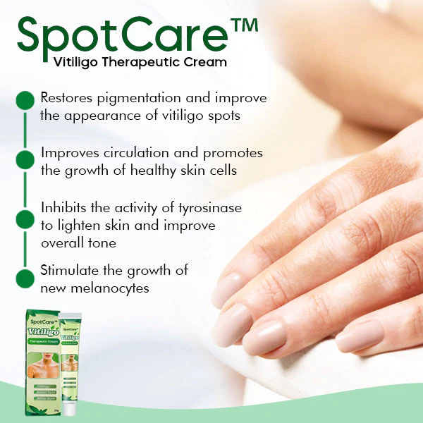 SpotCare Vitiligo Therapeutic Cream