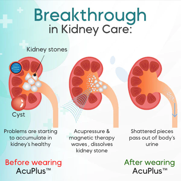 AcuPlus Kidney Care Point Clip