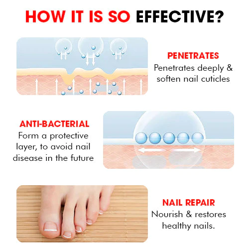 Nailcare Ingrown Toe Nail Drops