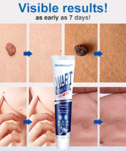 SkinDeluxe Wart-Removal Ointment