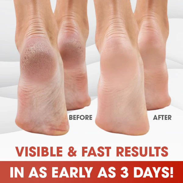 MedCare Revitalizing Foot Cream