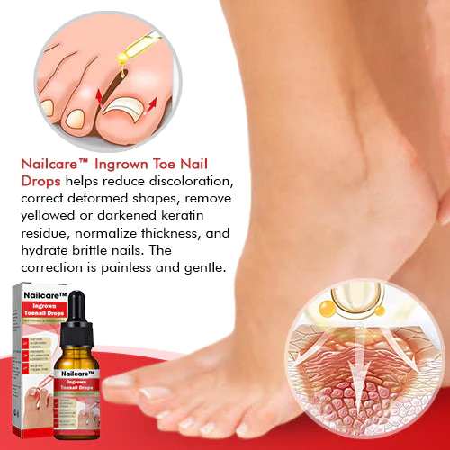 Nailcare Ingrown Toe Nail Drops