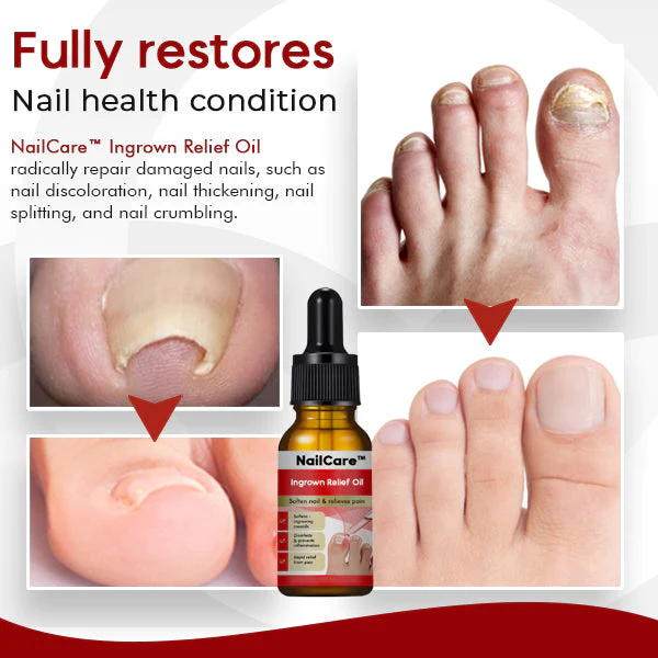 NailCare Ingrown Relief-Oil