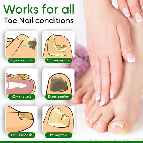 NailCare Toe Nail Treatment Gel