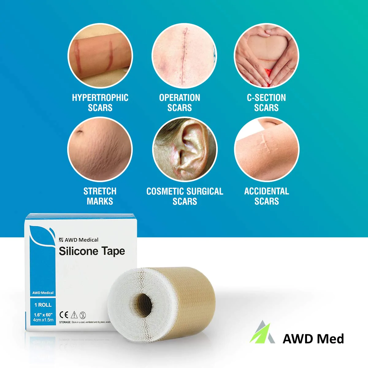 Medical Soft Silicone Gel Tape For Scar Removal