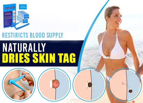 Skin Tag Remover Kit