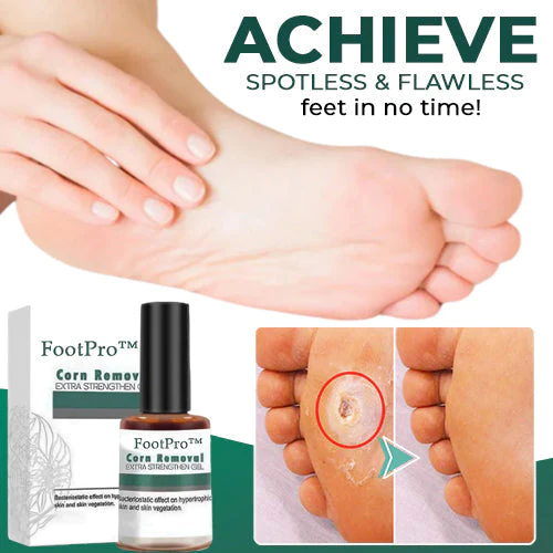 FootPro Corn Removal Extra Strengthen GelLimited time discount  last day