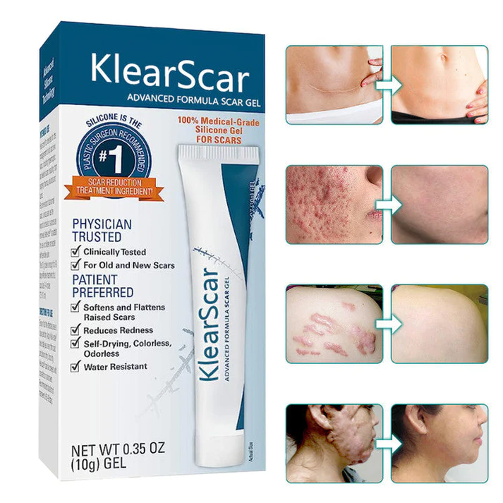 KlearScar Advanced Scar Removal Gel