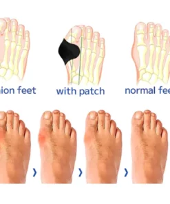 Ourlyard Bunion Pain Relief Patch