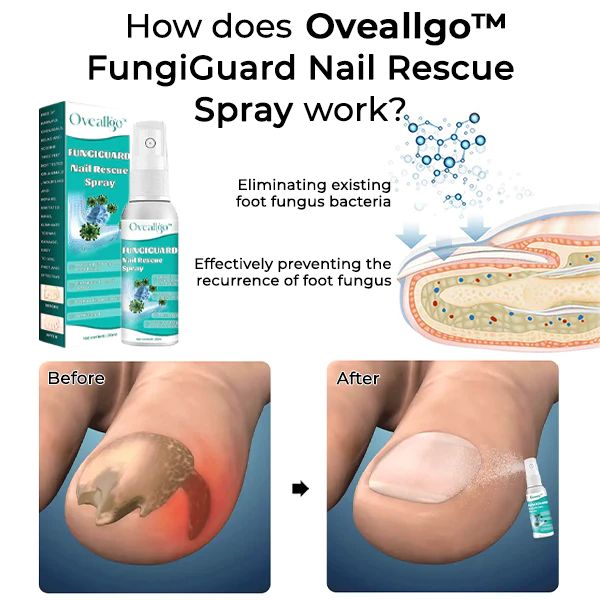 Oveallgo FungiGuard Nail Rescue Spray