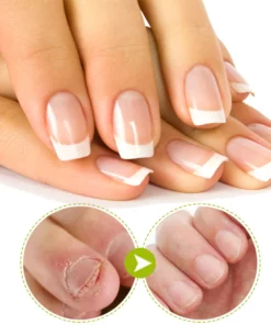 7Days NailRepair TreatmentGel