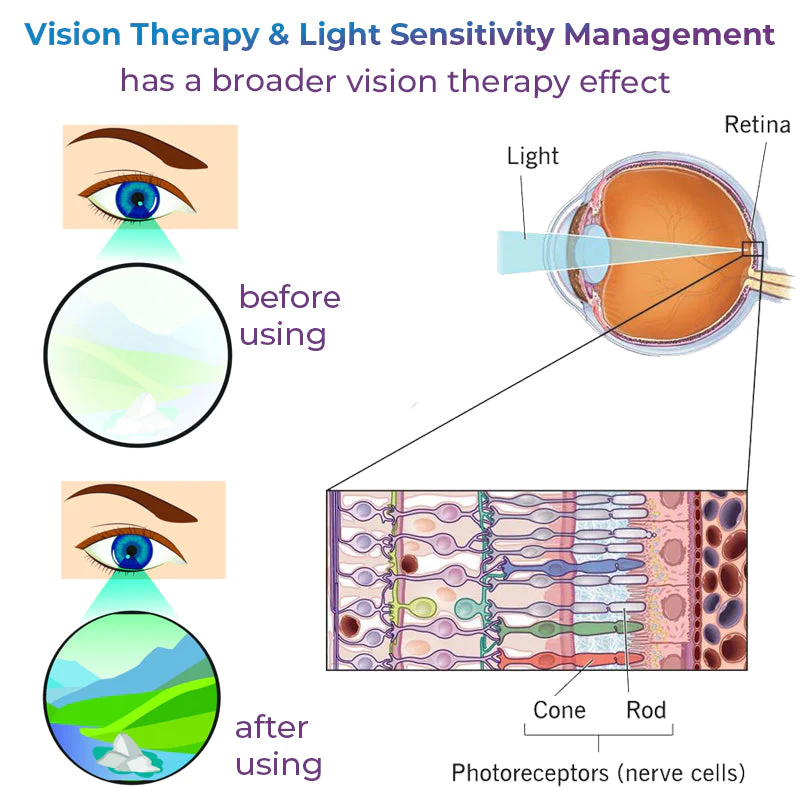 GFOUK Eye Therapy Patch