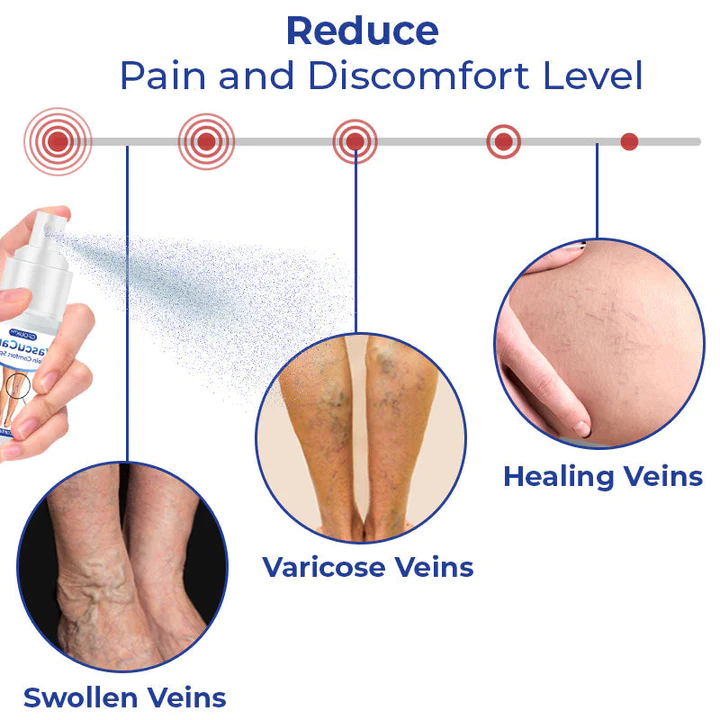 GFOUK VascuCare Vein Comfort Spray