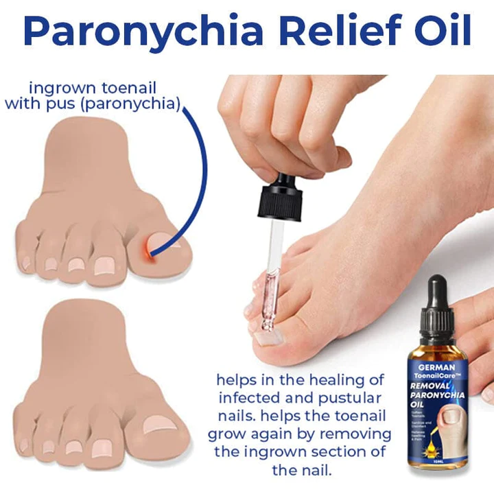 German Unpree Removal Paronychia Oil