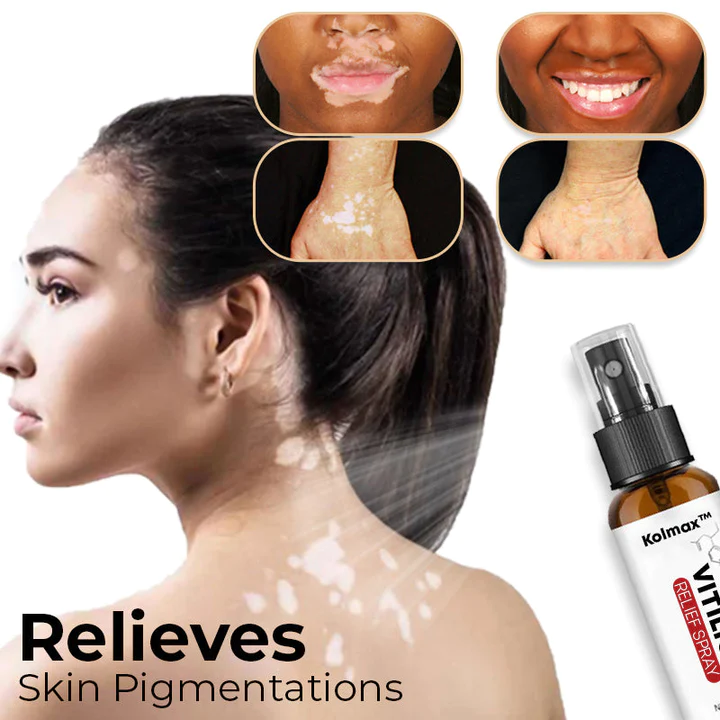 Kolmax Vitiligo Relief Spray