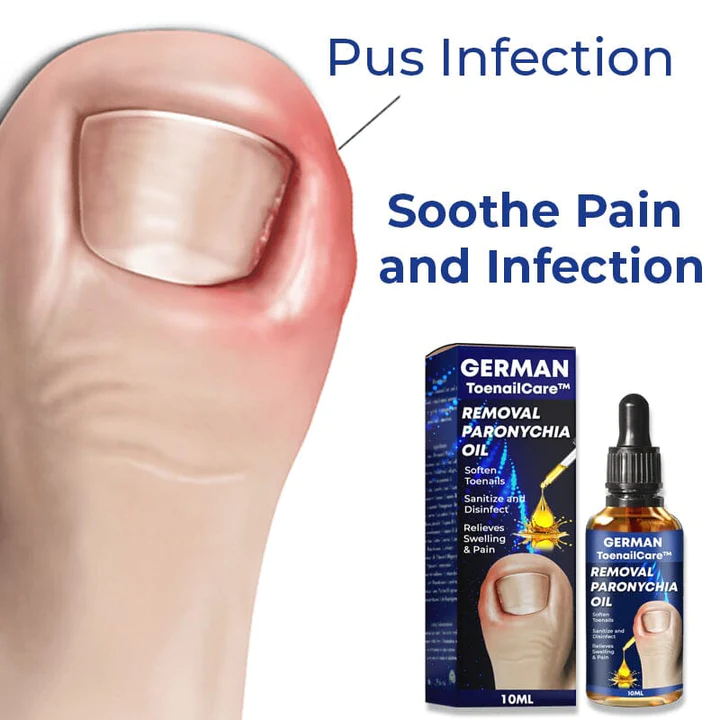 German Unpree Removal Paronychia Oil