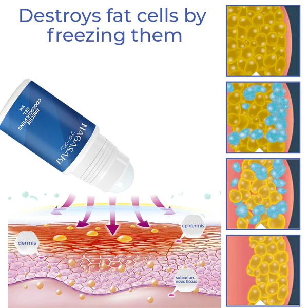 Nagasaki DermoFreeze Precise CoolSculpting Gel