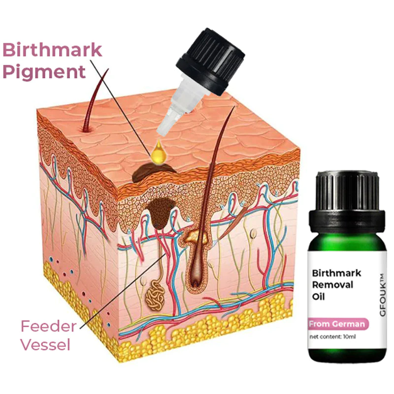 Oveallgo Birthmark Removal Oil