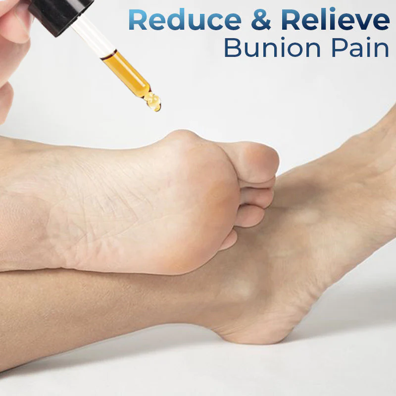 GFOUK German Bunion Relief Oil