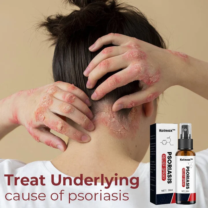 Kolmax Psoriasis Relief Spray