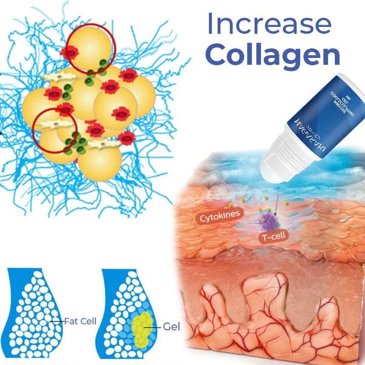 Nagasakiăă­ăźăşăł Precise CoolSculpting Gel