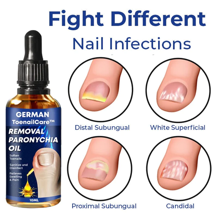 German Unpree Removal Paronychia Oil