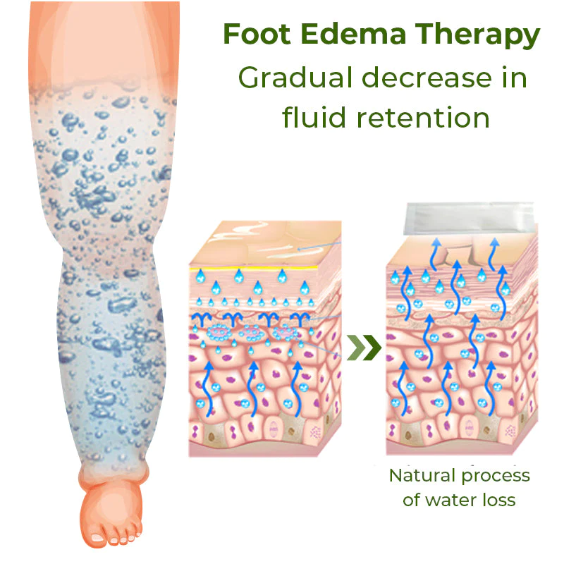 GFOUK Foot Edema Therapy Patch