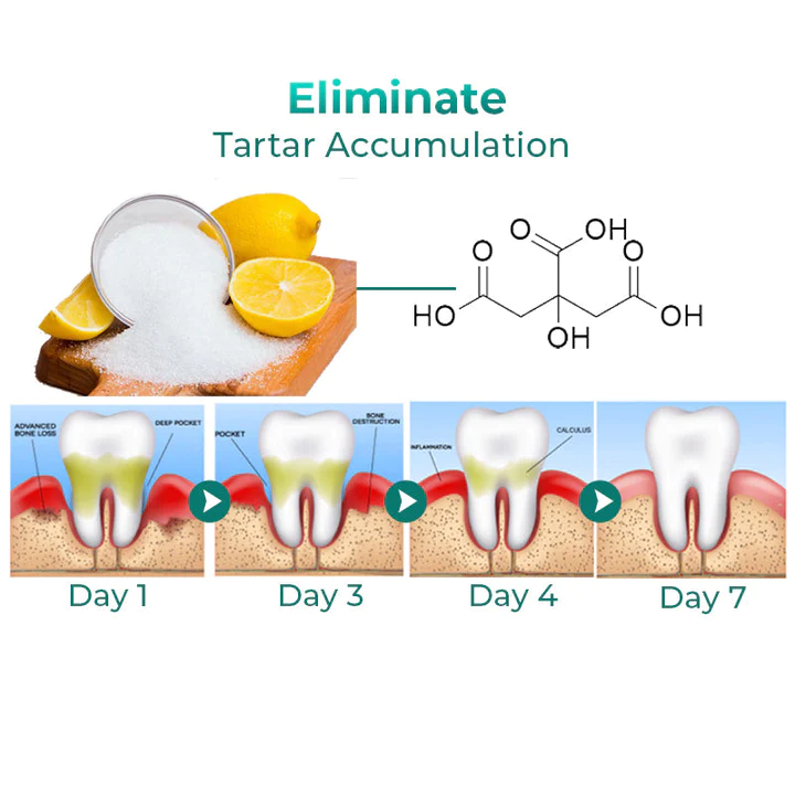 GFOUK Tartar Removal Foam