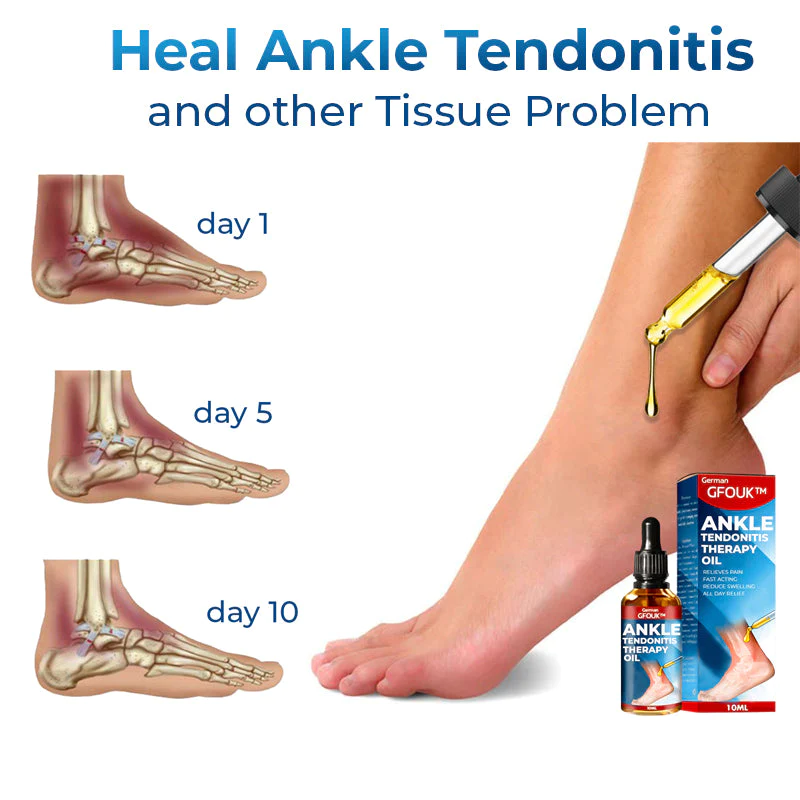 GFOUK German Ankle Tendonitis Therapy Oil