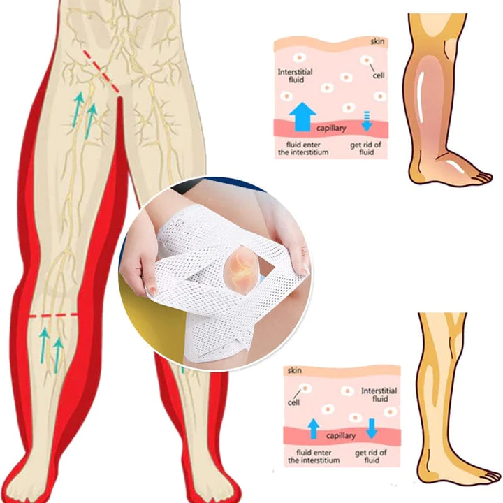 TrawDex AntiEdema Compression Strap