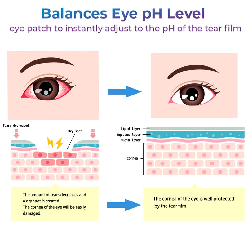 GFOUK Eye Therapy Patch