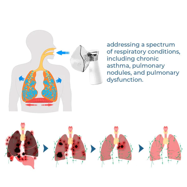 GFOUK LungDetox Nebulizer Cleansing Spray